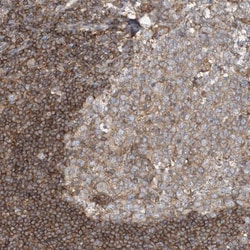 SFMBT2 Antibody, Novus Biologicals:Antibodies:Primary Antibodies